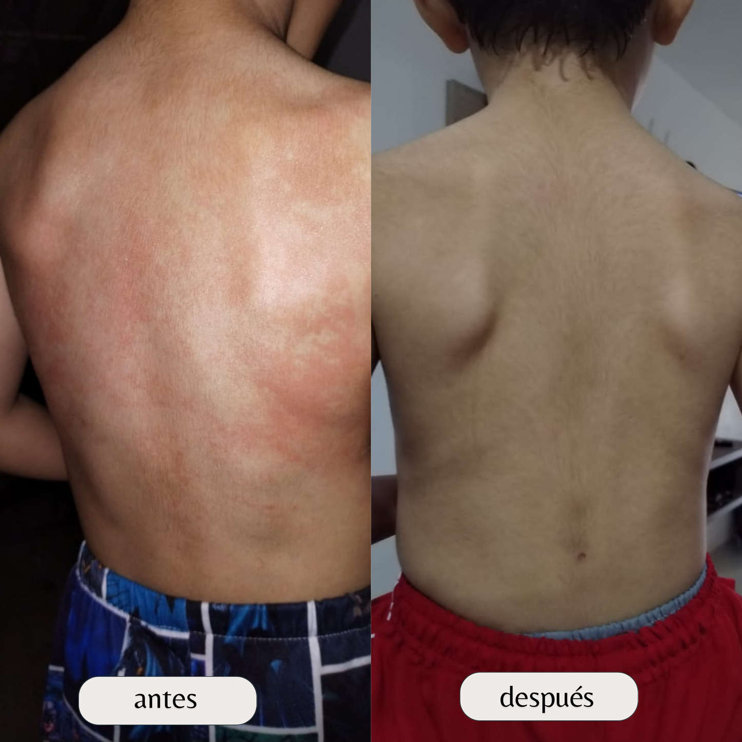 Kit Confort Corporal