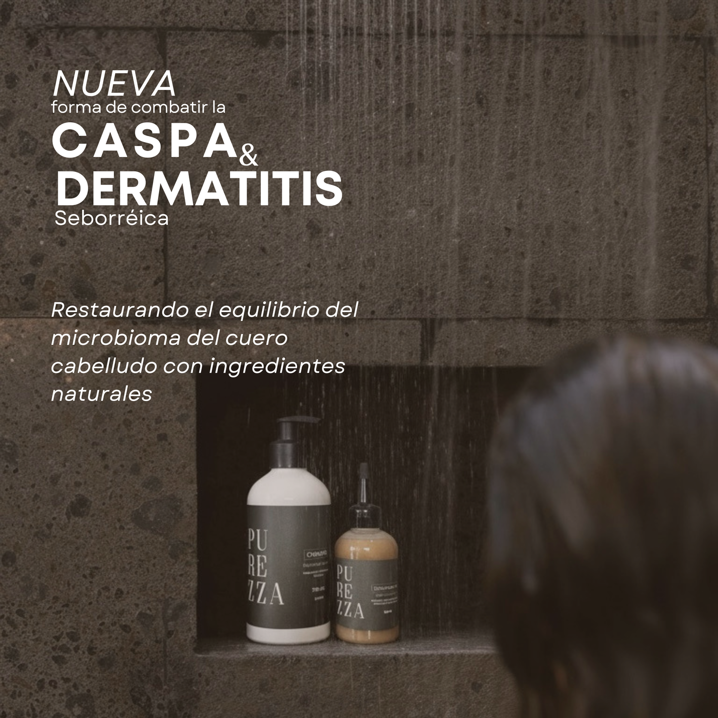 Kit Control Caspa, Grasa y Dermatitis Seborreica