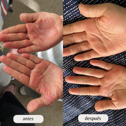 Kit para dermatitis y resequedad corporal