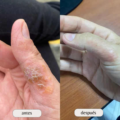 Kit para dermatitis y resequedad corporal
